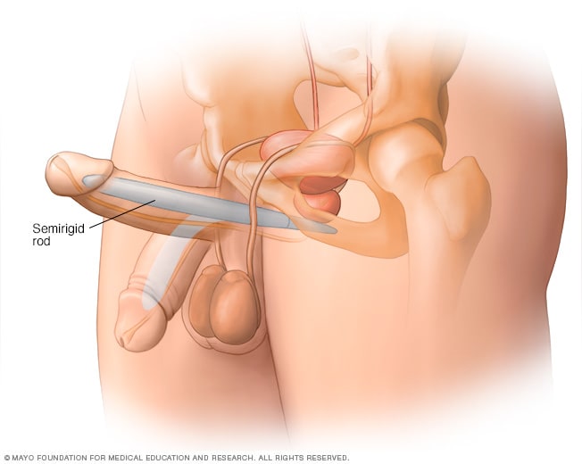 craig aggett add Rod In Cock photo