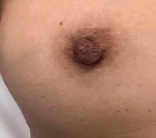 derek chivers add Fat Black Nipple photo