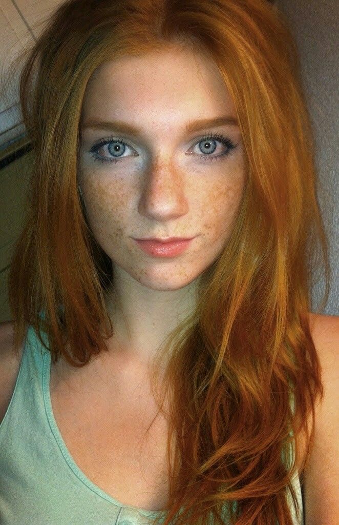 chris hoehne add Redheads With Freckles Nude photo