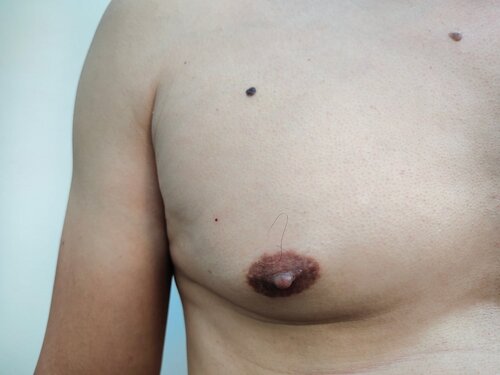 Huge Puffy Nippels 16535