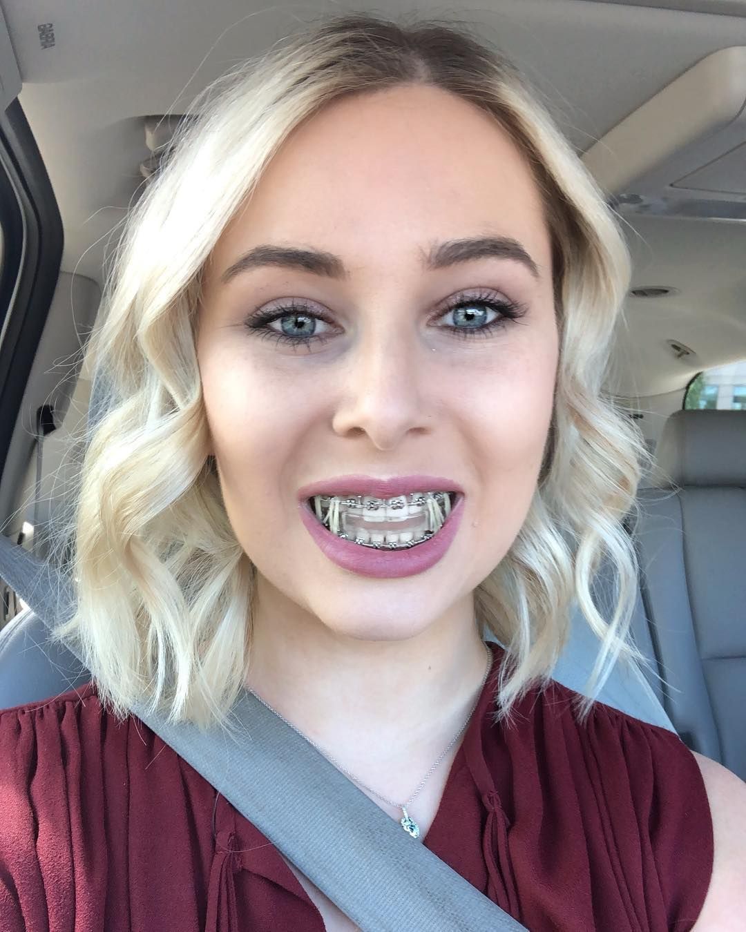 chloe ryan add Britney Braces photo