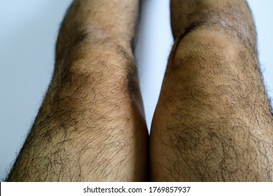 bob hodnett add Hairy Male Legs Pics photo