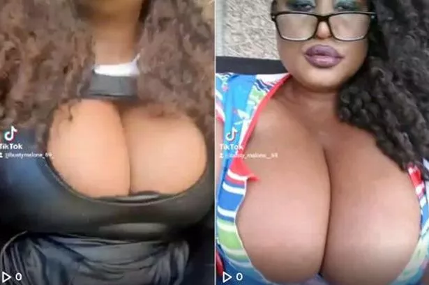 bidur khadka add Massive Webcam Boobs photo