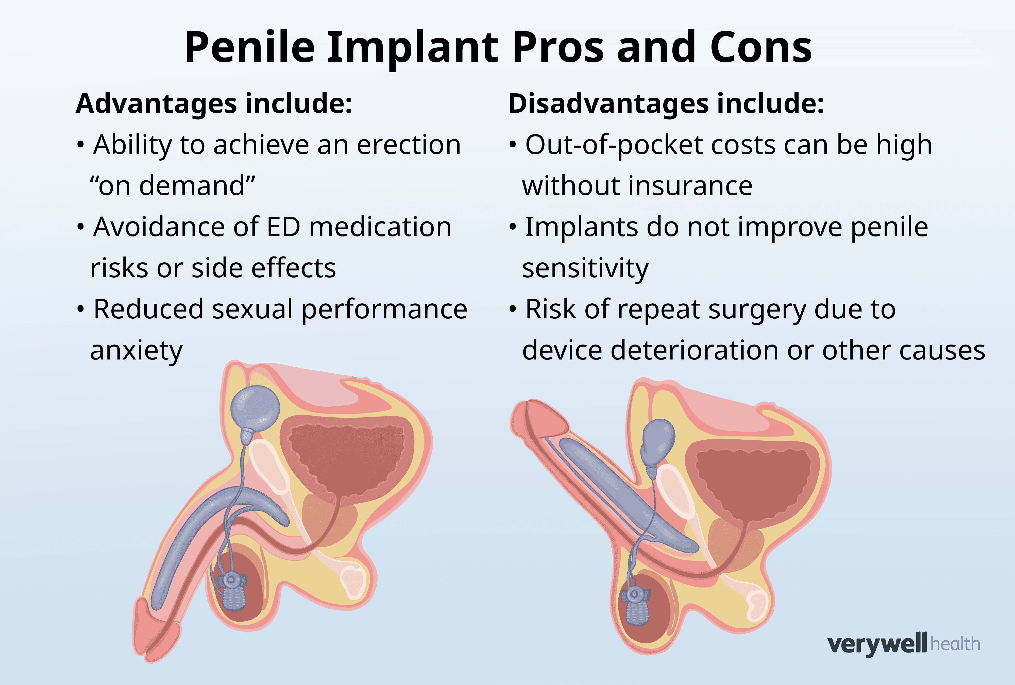 Penile Implant Porn 8949