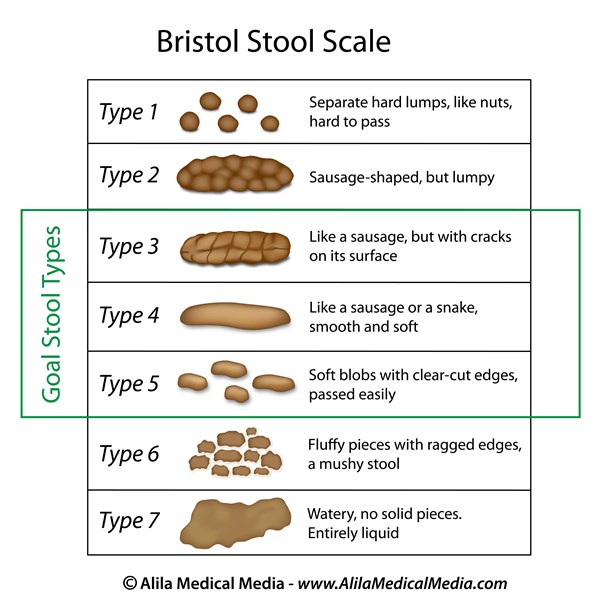 brian frishman add Anal Bar Stool photo