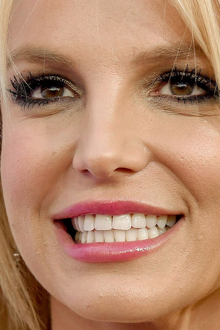 chadi jbeily add Britney Braces photo