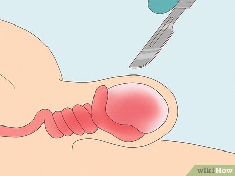anggi anggriani add Testicle Massage Video photo