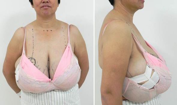 artie olsen add Enormous Saggy Tits photo