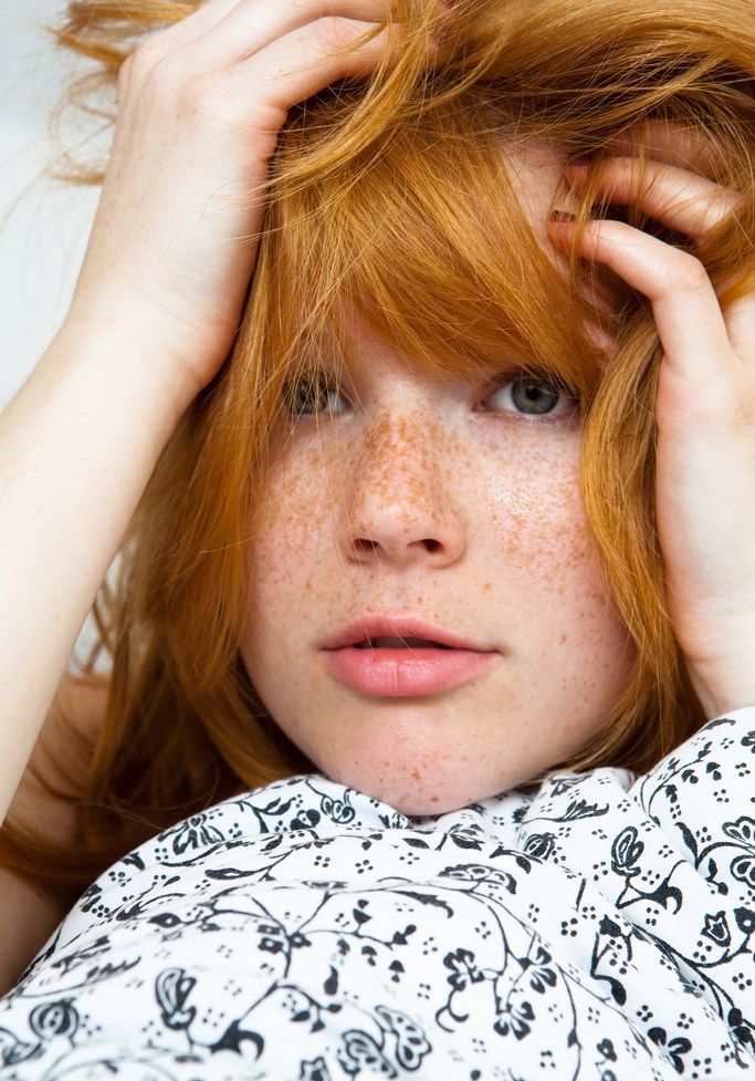 dillon mohammed add Redheads With Freckles Nude photo