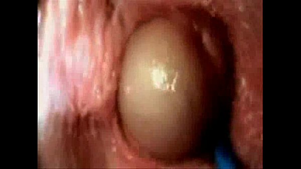 anju dalal add Internal Vagina Camera photo