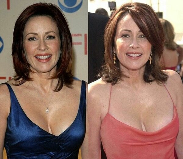 brian knutson add Patricia Heaton Measurements photo