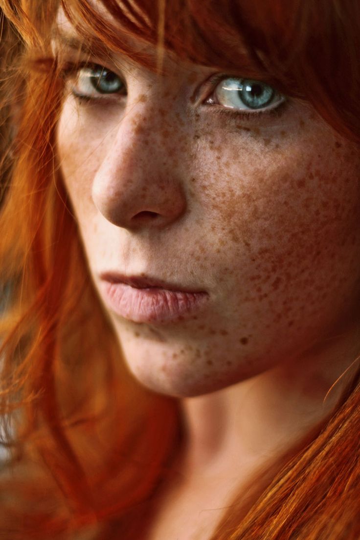 anne foley add Redheads With Freckles Nude photo